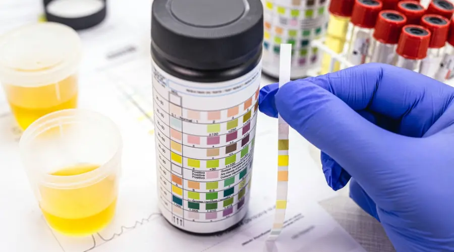 Does Ketamine Show Up on a 12 Panel Drug Test?